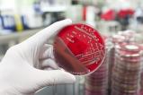 Pathogenic bacteria culture on an agar plate, © iStock.com / zmeel