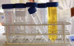 Test tubes in rack 