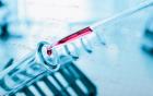 Test tube and pipette